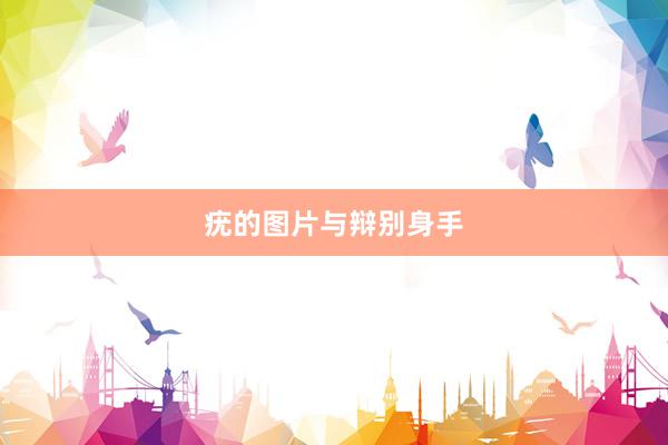 疣的图片与辩别身手